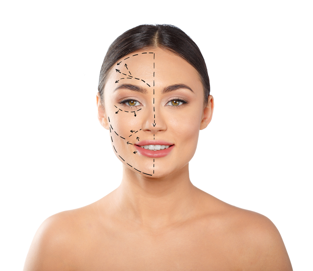 Woman,With,Dotted,Lines,On,Face,,Cosmetology