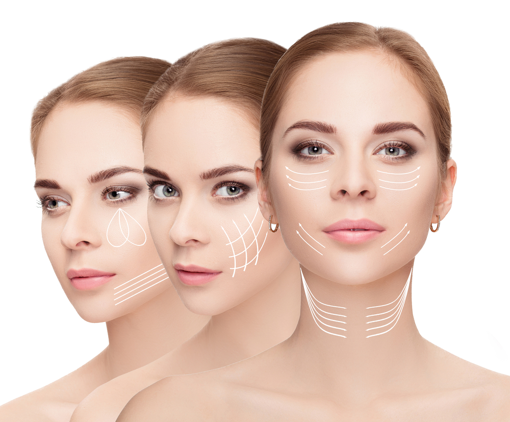 Woman,Faces,With,Arrows,Over,White,Background.,Face,Lifting,Concept.