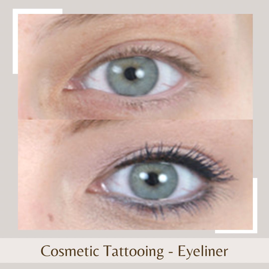 Cosmetic Tattoo - Eyeliner