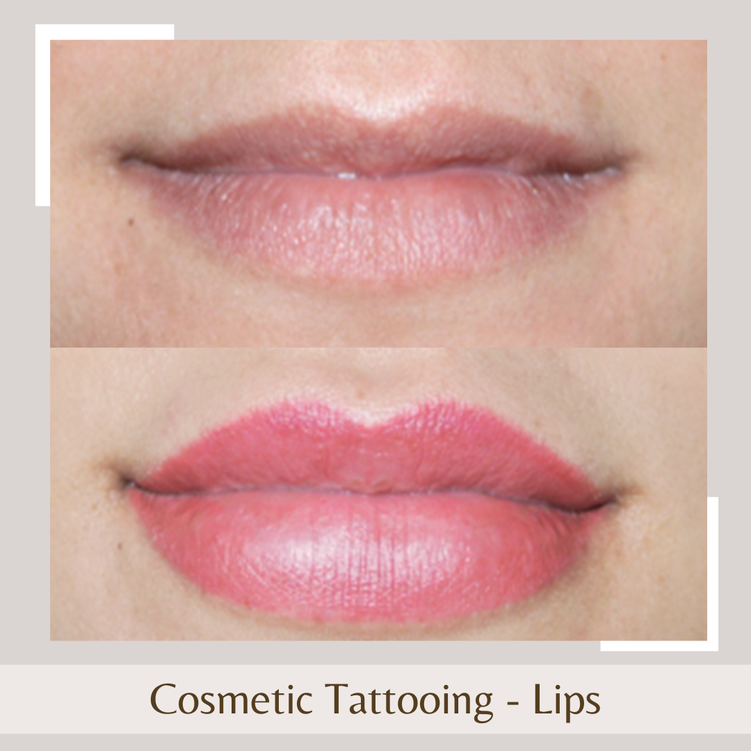 Cosmetic Tattoo - Lips1