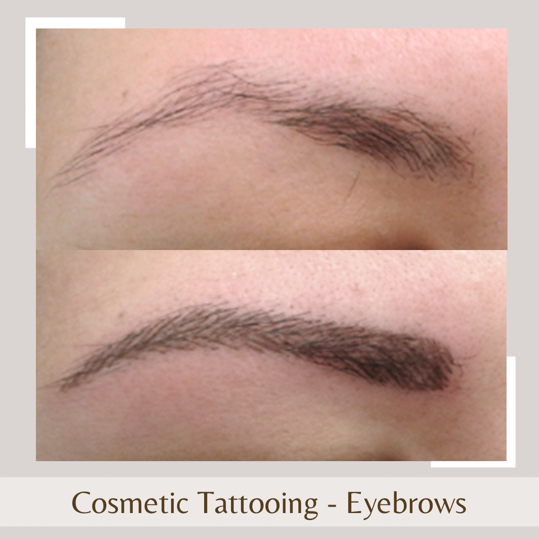 Cosmetic Tattoo - eyebrow