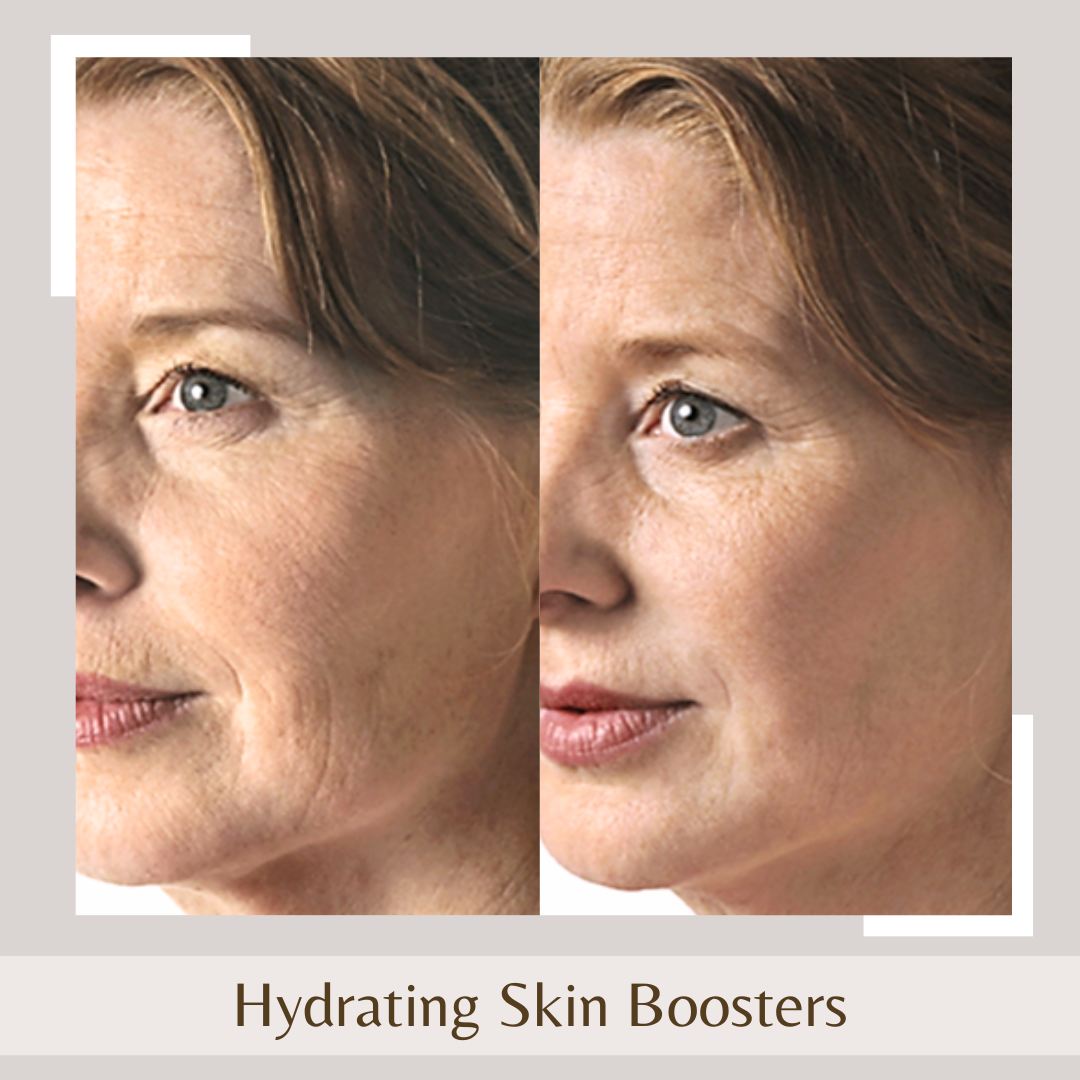 Hydrating Skin Boosters1