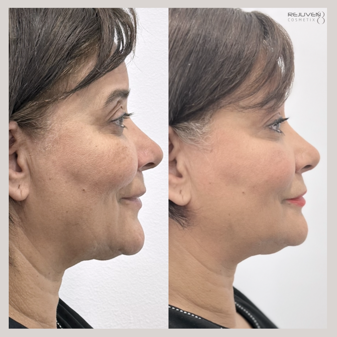 B&A Face Contour Filler 12